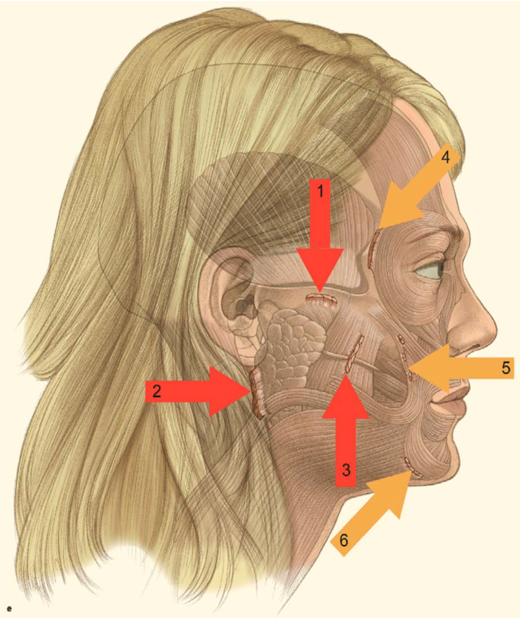 Жировые пакеты на лице фото анатомия