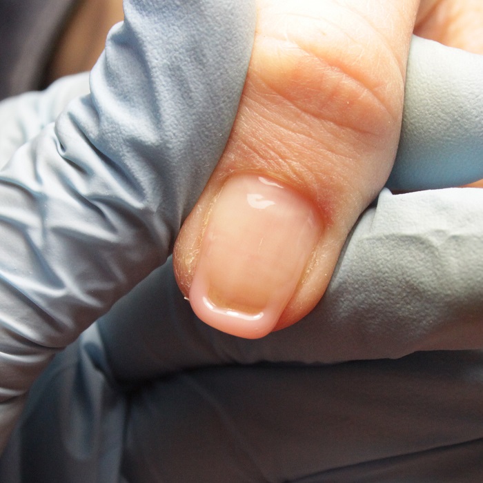 восстановление длины натуральных ногтей