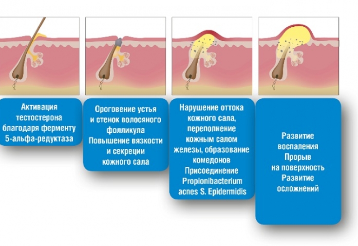 Когда перманентный макияж во вред: нарушения состояния кожи